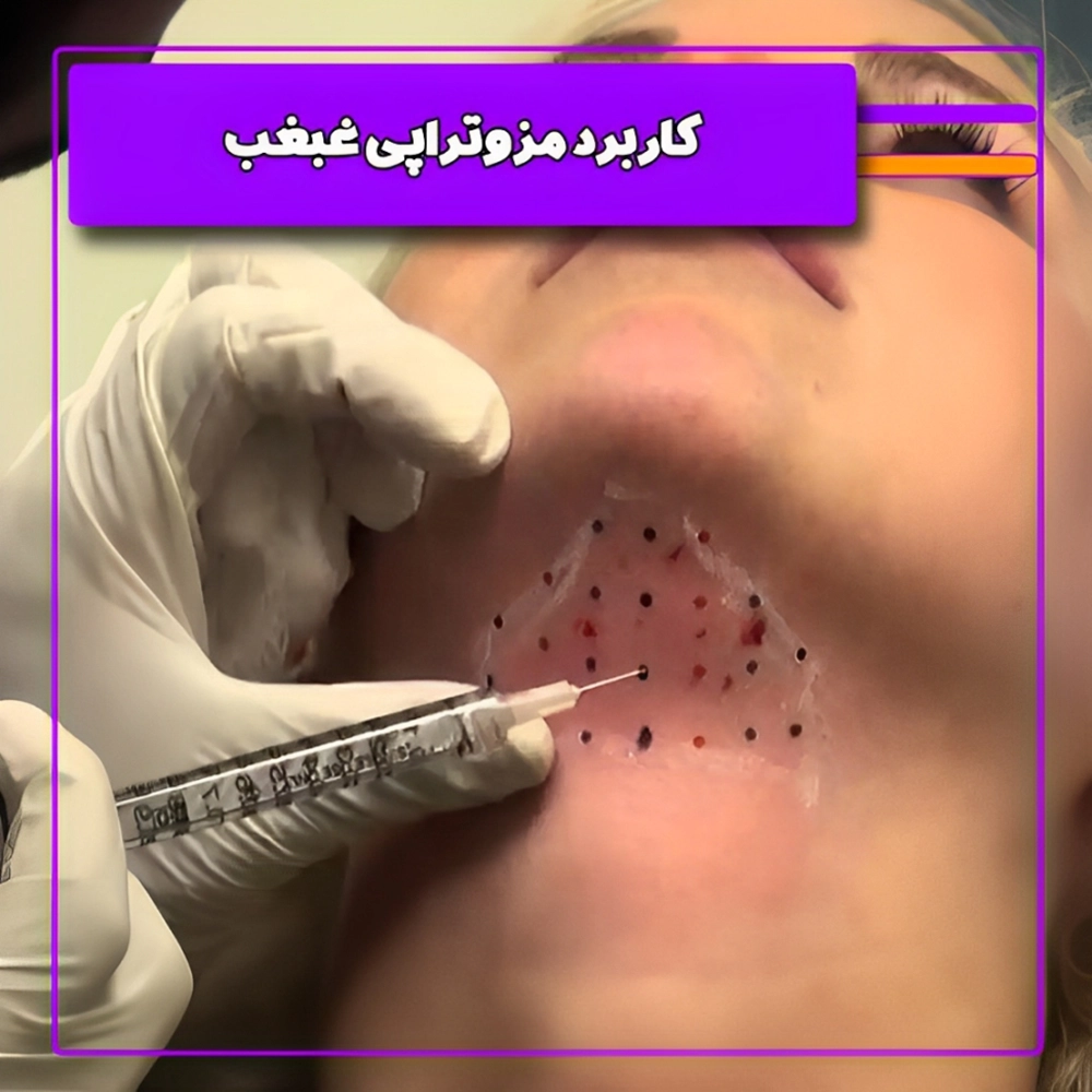 از بین بردن غبغب با مزوتراپی