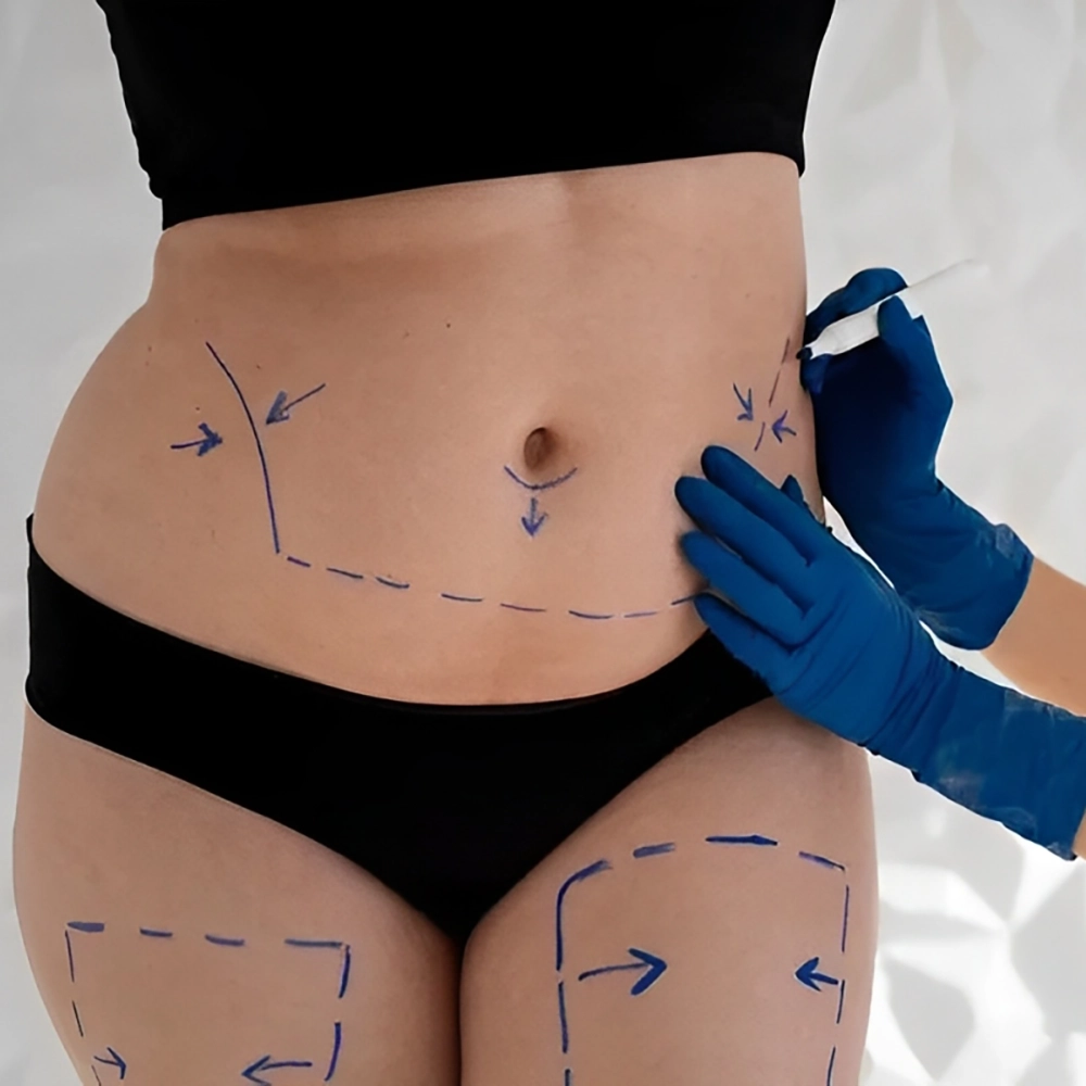 عوارض کوکتل لاغری فیوژن
